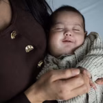 Le bébé Issa, soigné d'une tumeur vasculaire